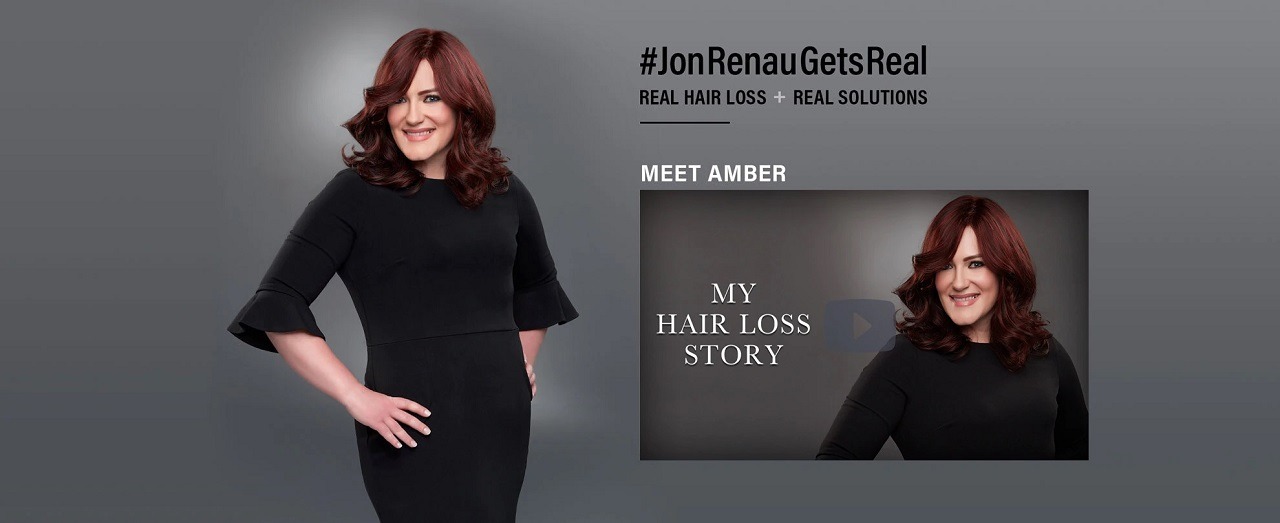An amazing hairloss story by amber