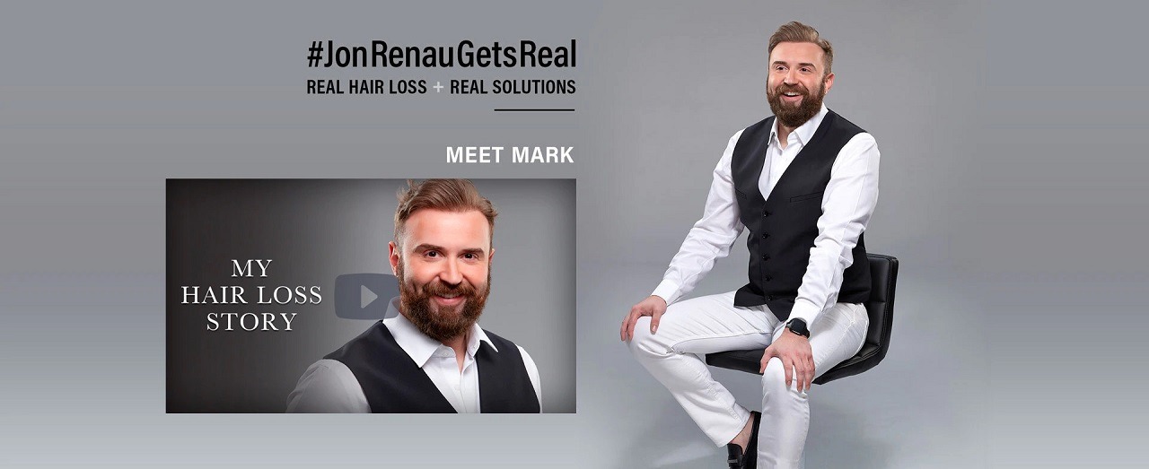 Watch how we transform our male model with hair loss