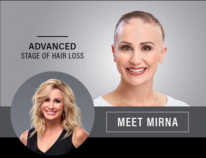Lady with Alopecia gors through a transformation with a wig