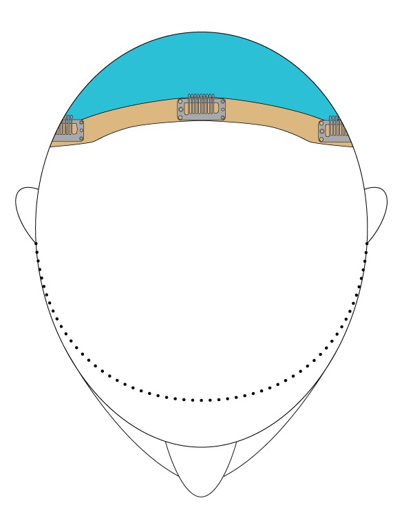 easiCrown hair topper placement area and coverage