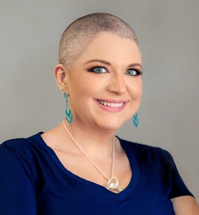 Christine suffers for severe hair loss and has alopecia areata