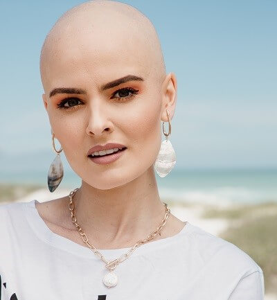 Smiling Lady showing her bald head